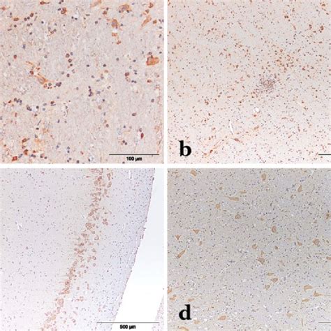 Immunohistochemical Labeling Of Cdv Np Antigen In Different Brain