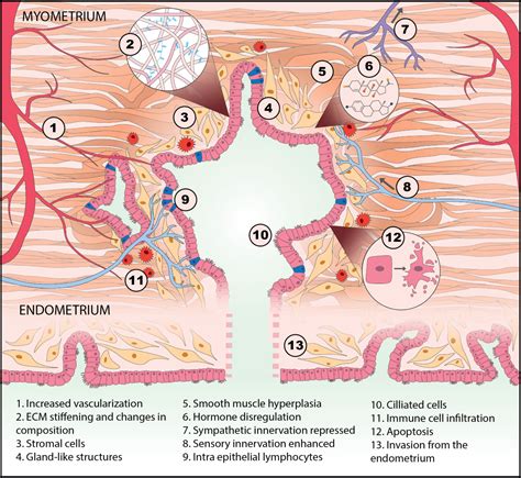 Research • The Mit Center For Gynepathology Research