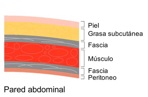 Peritoneo Paradigmia