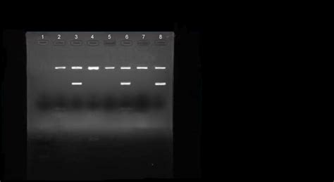 2 Agarose Gel Under Uv Illumination After Electrophoresis For Sex Download Scientific Diagram