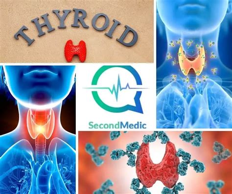 Thyroid Disease: Causes, Symptoms, Risk Factors