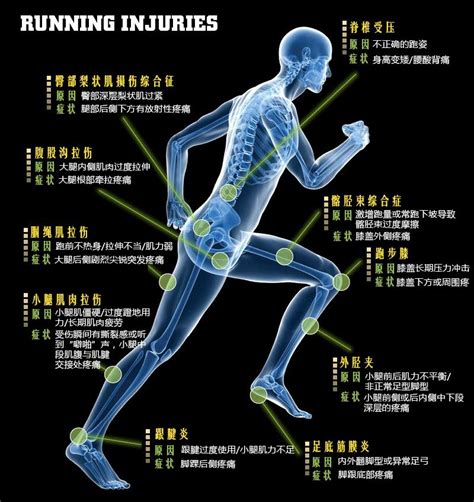 跑步受伤了怎么办这本跑步损伤自救指南请收下 知乎