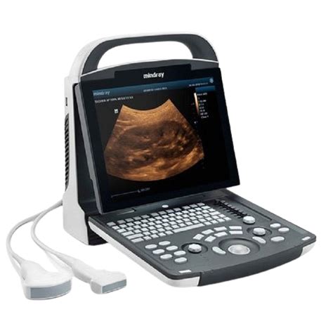 Portable Ultrasound Modernquip Medical Supplies