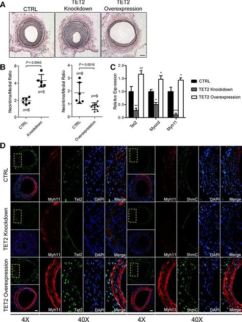 Ten Eleven Translocation Tet Is A Master Regulator Of Smooth