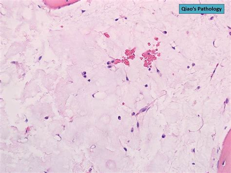 Qiaos Pathology Serous Atrophy Of Bone Marrow Microscopi Flickr