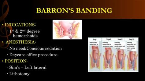 Hemorrhoidectomy Operative Surgery