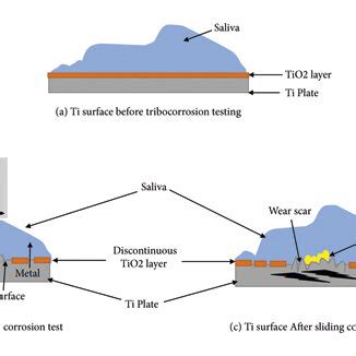 Factors Responsible For Bio Tribocorrosion Of Dental Implants In Oral