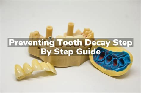 Preventing Tooth Decay Step By Step Guide Comprehensive Dental Care