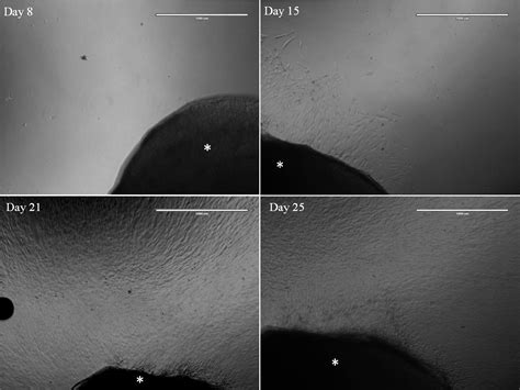 Figure 1 From Ex Vivo 3D Human Corneal Stroma Model For Schnyder