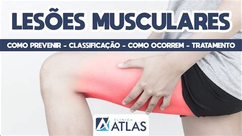 Les Es Musculares Como Prevenir Classifica O Como Ocorrem