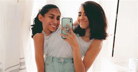 Conjoined Twin Sisters Lupita And Carmen Andrade What We Want You To Know