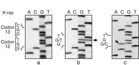 Genetic Alterations In K Ras And P53 Cancer Genes In Lung Neoplasms From B6c3f1 Mice Exposed To