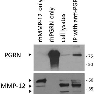 Pgrn Is Cleaved By Macrophage Elastase Mmp In Human Microglia A