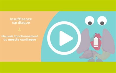 Vidéo deux minutes pour comprendre l insuffisance cardiaque Masanté re