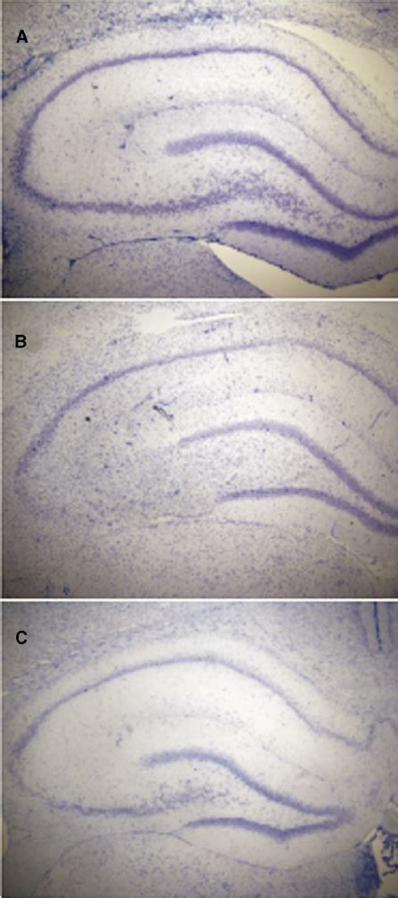 MnTBAP Protects Against Kainate Induced Hippocampal Damage Cresyl