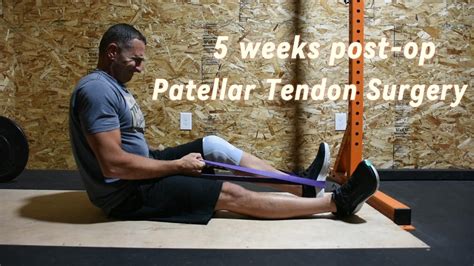 Update 5 Weeks Post Op After Ruptured Patellar Tendon Repair YouTube