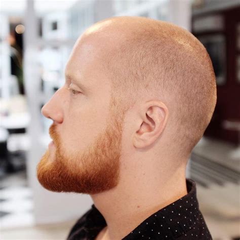 Male Pattern Baldness Balding Haircuts