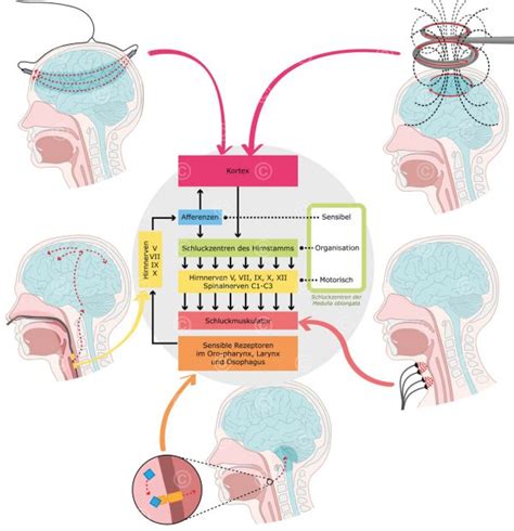 Illustrationen Dysphagie MedicalGraphics