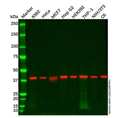 Recombinant Aldolase Antibody Primary Antibody Aldoa Aladdin