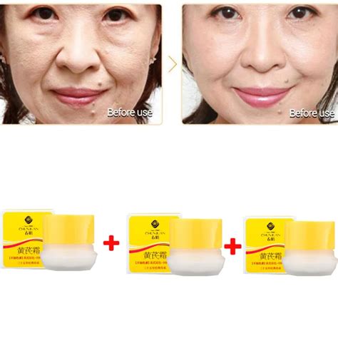 Traditional Chinese Medicine Cosmetics Astragalus Cream Skin Care