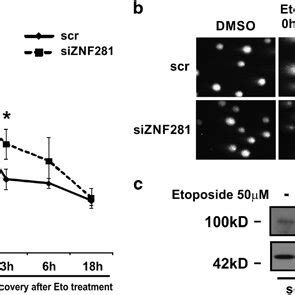 Silencing Of Znf Delays The Execution Of Dna Repair A Neutral