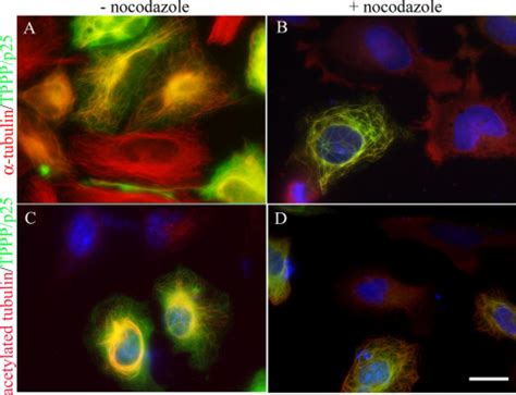 Tppp P Promotes Tubulin Acetylation By Inhibiting Histone Deacetylase