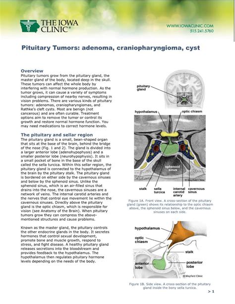 Pituitary Tumors Adenoma Craniopharyngioma Cyst Docslib