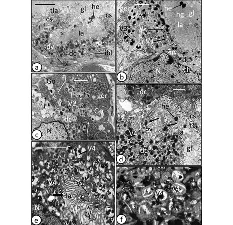 Transmission Electron Microscope Tem Photomicrographs Of Adult And