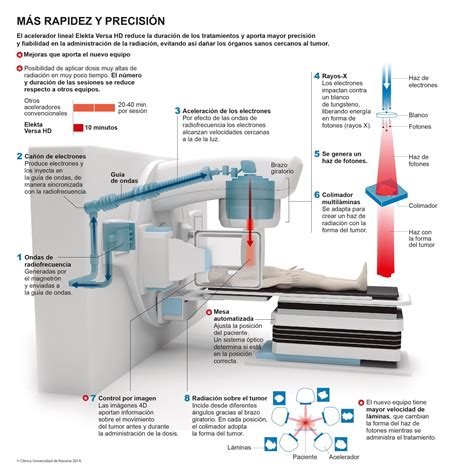 ASÍ FUNCIONA EL ACELERADOR LINEAL PARA LA RADIOTERAPIA incluye vídeo
