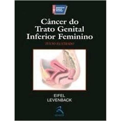 Livro Câncer Do Trato Genital Inferior Feminino Submarino