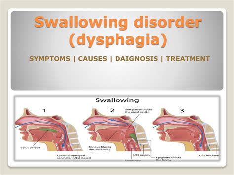 PPT - Swallowing disorder (dysphagia) in children- Causes, Symptoms