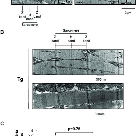 Electron Micrographs Of Gastrocnemius Muscle From To Month Old