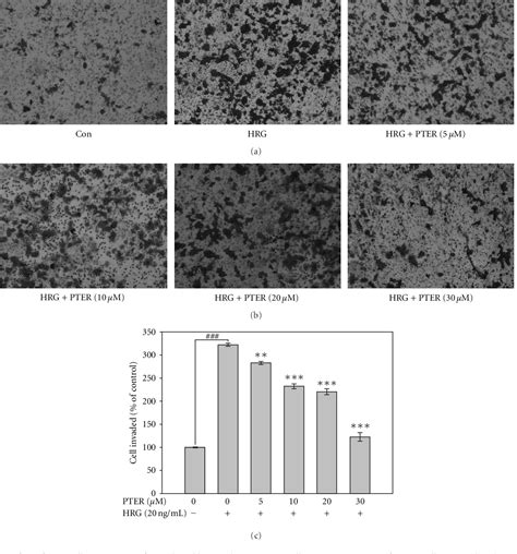 Figure 2 from Suppression of Heregulin β1 HER2 Modulated Invasive and