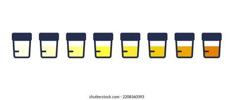 Urine Color Chart Icon Clipart Image Stock Vector Royalty Free