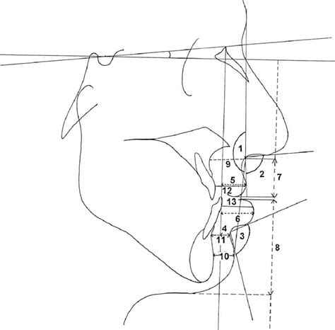 E Soft Tissue Measurements 1 Facial Convexity Angle 2 Nasolabial Download Scientific