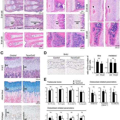 Histological And Histomorphometric Analysis Of The Long Bones Of