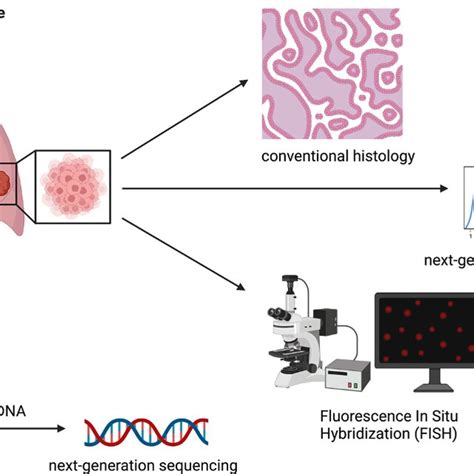 Modern Tumor Profiling In Lung Cancer 1 Tumor Profiling From Primary