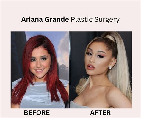 Ariana Grande Plastic Surgery All Details Revealed Fabbon