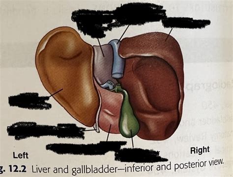 Ch Biliary Tract Upper Gi Flashcards Quizlet