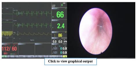 9 demonstrates a mock-up of an enlarged image view of drug-induced... | Download Scientific Diagram