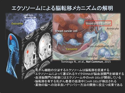 乳がんの脳転移メカニズムにエクソソームが関与 脳転移の早期診断への応用に期待｜国立がん研究センター