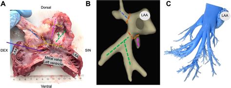 Frontiers 3D Electroanatomical Mapping Of The Left Atrium And