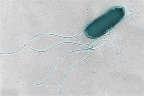 A bacterium that causes food-borne illness grows flagella under ...