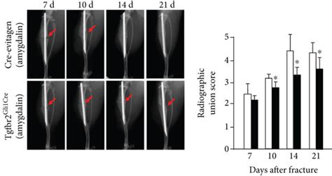 Amygdalin Promoted Bone Fracture Healing In The Cre Negative Group