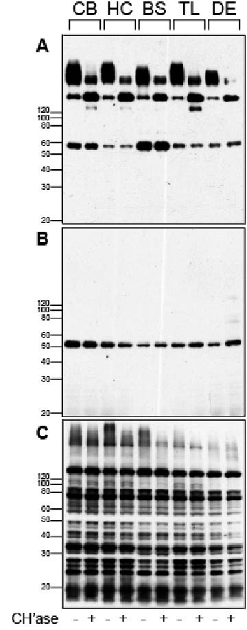 Binding Of Wisteria Floribunda Agglutinin WFA Lectin To Fixed Tissue