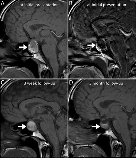 Magnetic Resonance Imaging Of The Sellar Region Magnetic Resonance