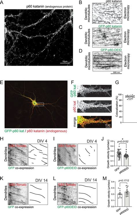 Functional Inhibition Of Katanin Affects Synaptic Plasticity Journal