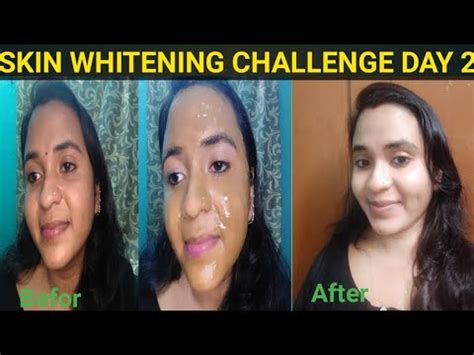 Skin Whitening Challenge Day