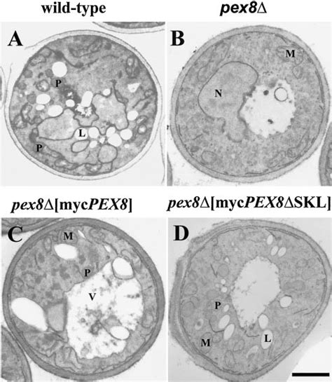 Mutant Pex8 Cells Lack Morphologically Detectable Peroxisomes Electron