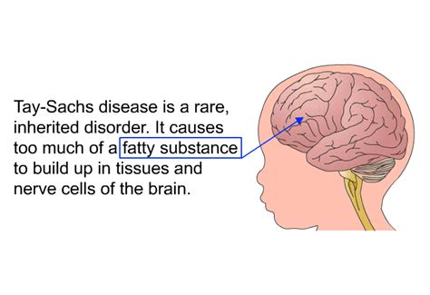 PatEdu.com : Tay-Sachs Disease